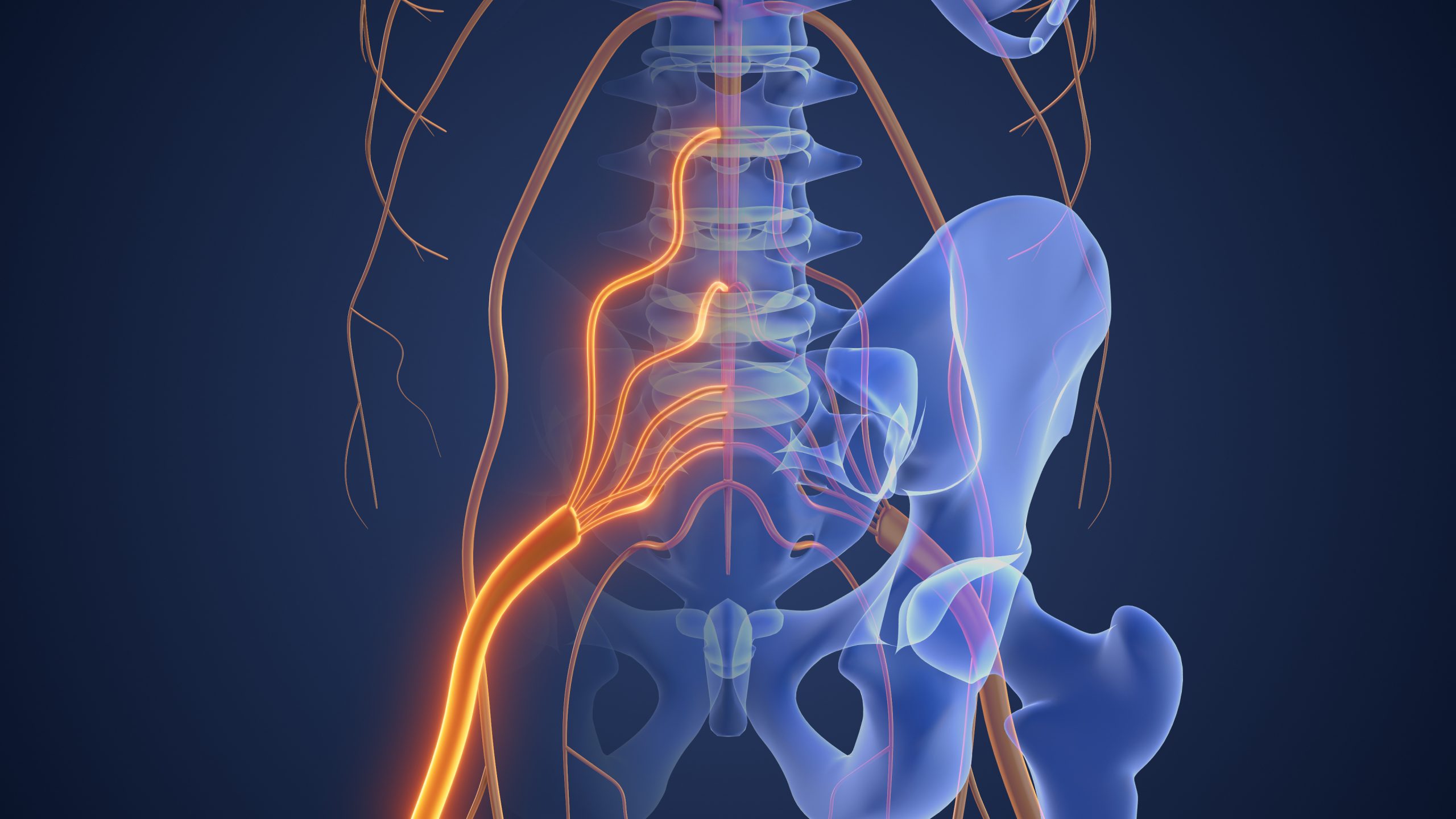 Lumbar Radiculopathy and how it affects the nerve roots in the lower body.